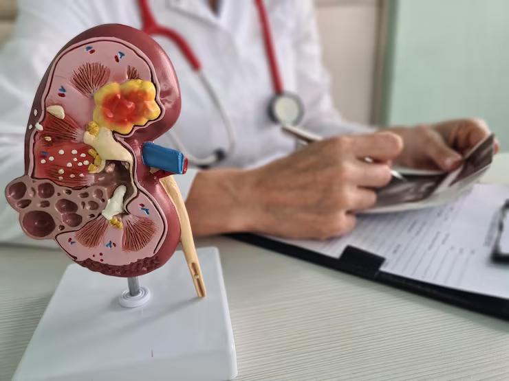 Transplante renal