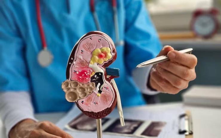 Doença Renal