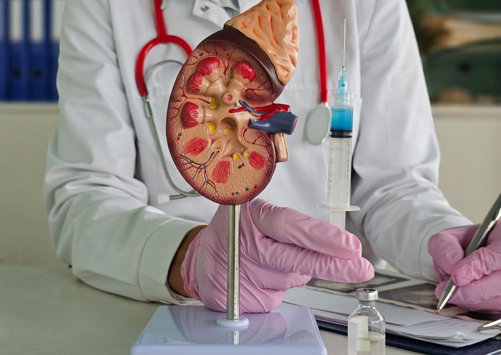 Transplante Renal