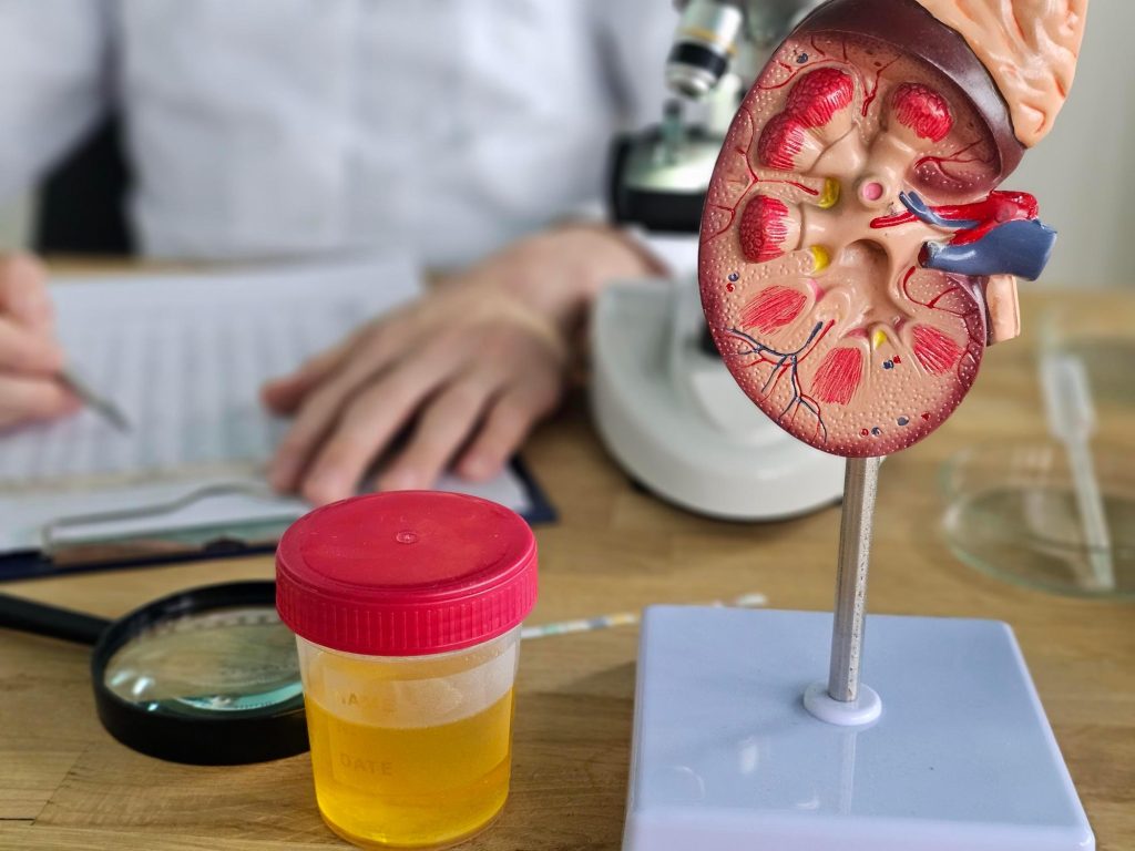 Anemia na insuficiência renal