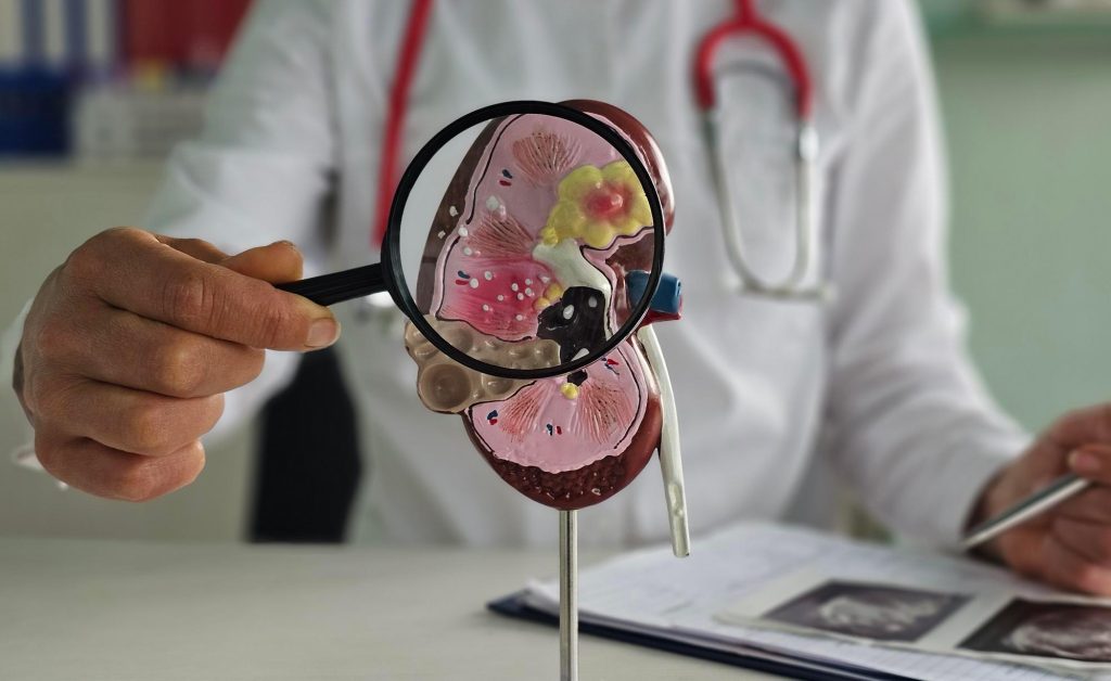 Fósforo e doença renal